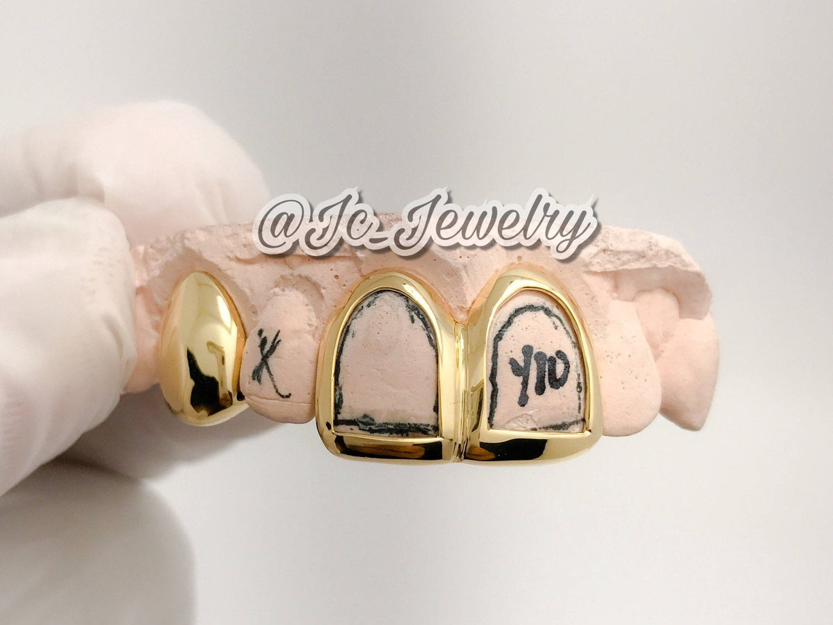 Custom 3 Piece Open Face Solid Real 10k Gold Grillz Houston Texas Grillz