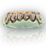 Custom Open Face Fangs & 4 With Diamond Dust
