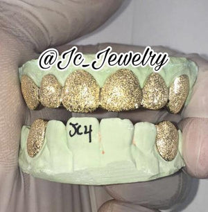 Top Grillz By Houston Texas Grillz - The Finest Gold Teeth Dealer Near You