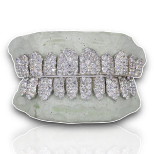 Custom Jumbo VVS Moissanite Diamond Grillz