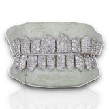 Custom Jumbo VVS Moissanite Diamond Grillz