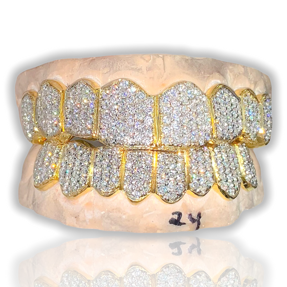 Custom Silver Fully Bustdown Diamond Iced Out Grillz (Zig Zag Cz Setting)