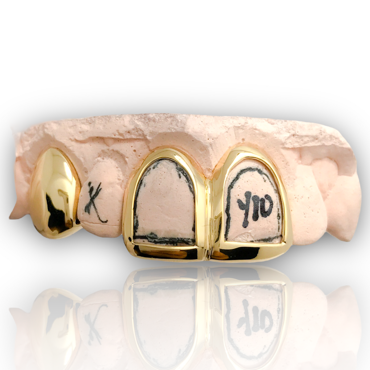 Custom 3 Piece Open Face Solid Real 10k Gold Grillz Houston Texas Grillz
