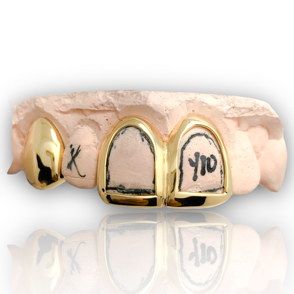 Custom 3 Piece Open Face Solid Real 10k Gold Grillz